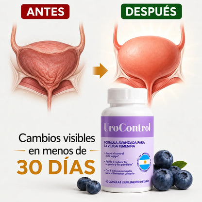 Urocontrol